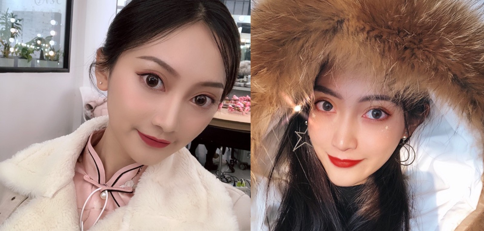 面部吸脂多久能恢复出效果？武汉涵美面部吸脂案例展示