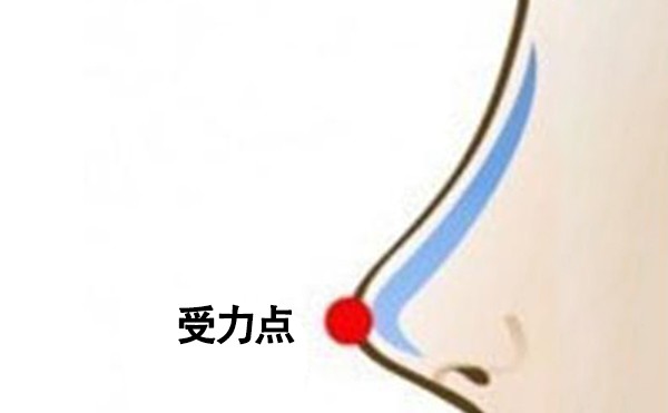 北京隆鼻失败修复多少钱？隆鼻修复手术多久能恢复自然呢？