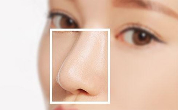 假体隆鼻后鼻子会发生变形吗？术后可以一辈子不用取出来吗？