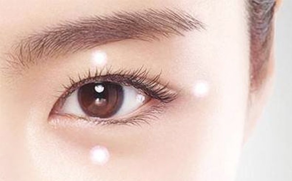 韩式三点双眼皮的优点是什么？三点双眼皮术后怎么避免不对称？