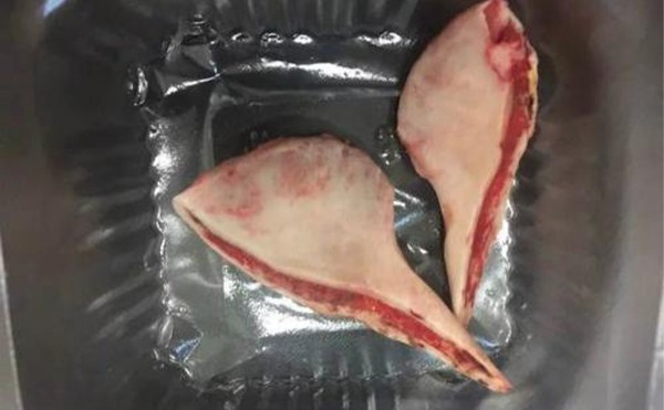 下颌角整形术后就该这么做？下颌角整形手术效果如何？