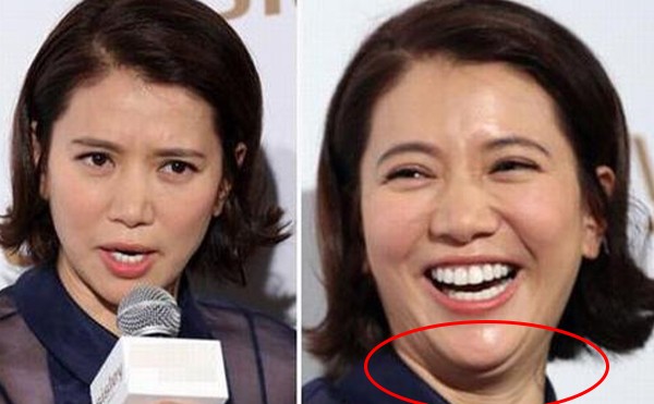 人为什么会有双下巴呢？去双下巴有什么方法？