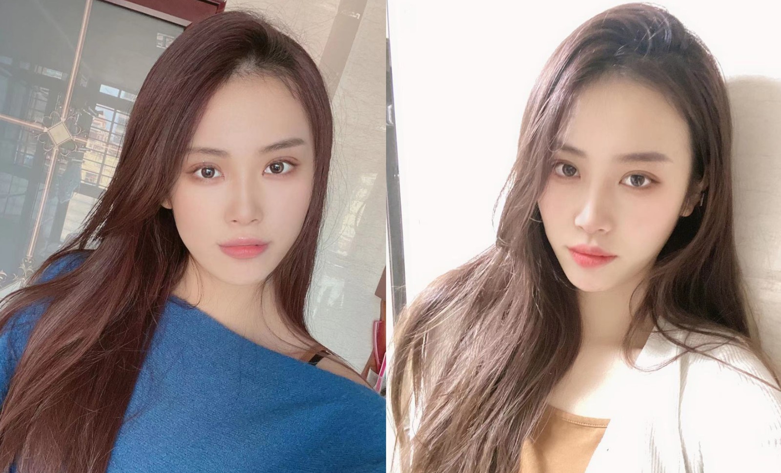 宁波艺星美容整形医院怎么样？是正规的吗？