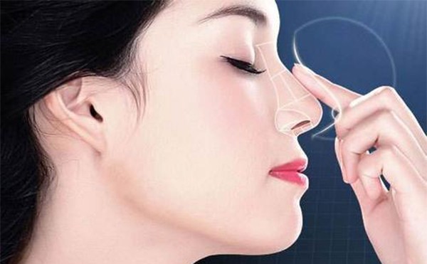 鼻小柱缺损修复会留疤么？哪些人不能做鼻小柱缺损的修复手术？