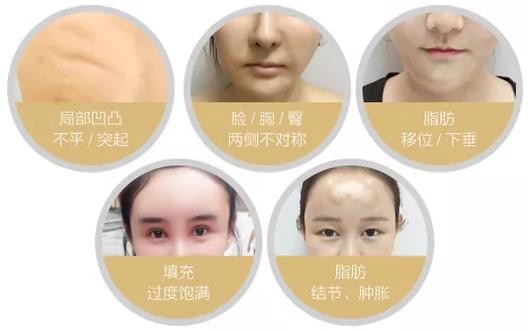 自体脂肪填充失败怎么修复？自体脂肪填充失败修复方法有哪些？