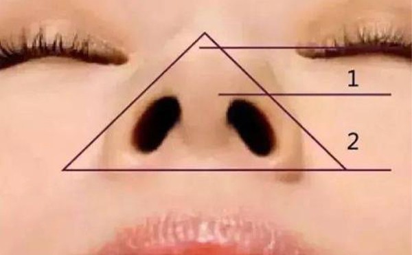 鼻小柱缺损修复方法有哪些？鼻小柱缺损是什么原因？