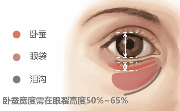 卧蚕多宽好看？卧蚕整形需要多少钱？