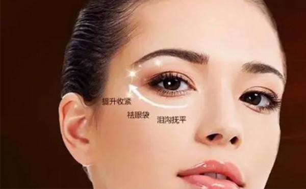 去眼袋手术能维持几年？眼袋做手术后会反弹吗？
