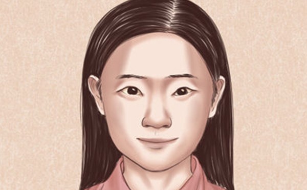 如何改善倒三角眼？倒三角眼改善有什么注意事项？