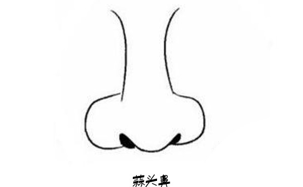 福州名韩整形改善蒜头鼻大概要花多少钱？鼻头肥大矫正有哪些风险？