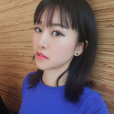 眼综合术前VS术后，自然大眼睛值得称赞！