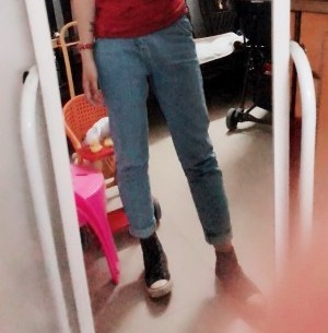 胖腿女孩儿福利分享：吸脂瘦大腿的蜕变，效果值得点赞！