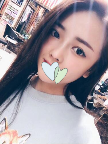 厦门海峡整形鼻综合案例分享，这鼻子可以滑滑梯了