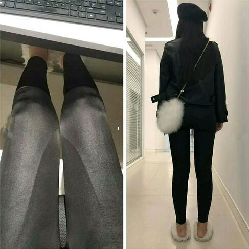 4800做的大腿吸脂，效果竟然还不错