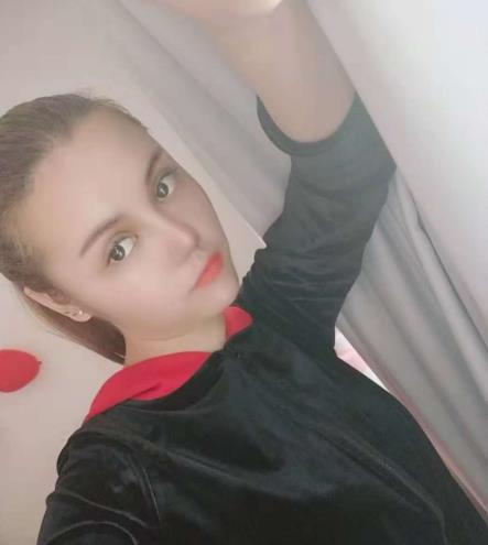 长沙雅美眼鼻整形案例术后三个月效果