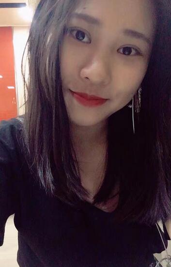 肇庆华美整形切开双眼皮术后三个月