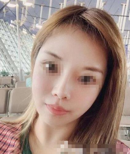 南京阅颜整形瘦脸针注射后半个月
