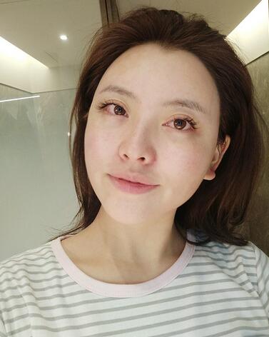 上海首尔丽格朴兴植下颌角整形一个月