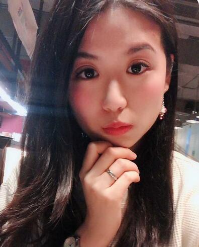 汕头曙光整形皮秒激光祛斑一个月效果