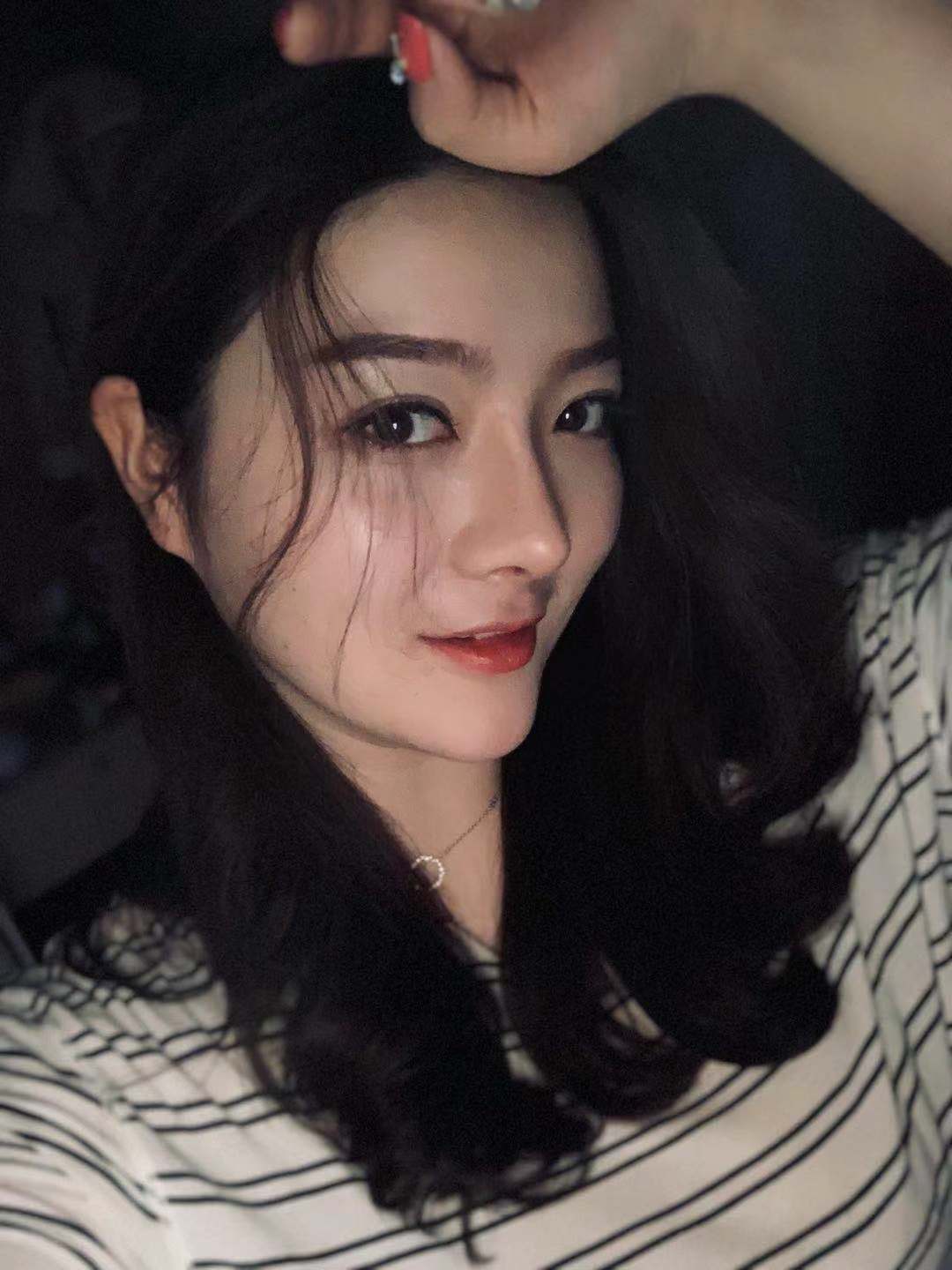 北京圣嘉荣二次鼻修复术后一个月