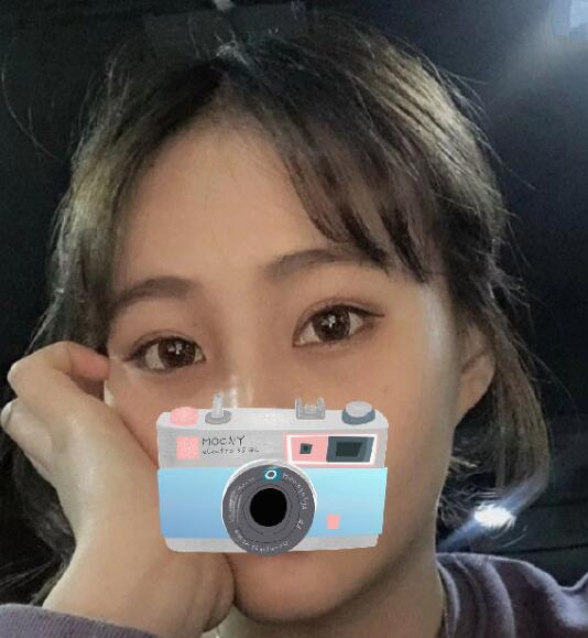 重庆华美整形下颌角整形术后三个月效果分享