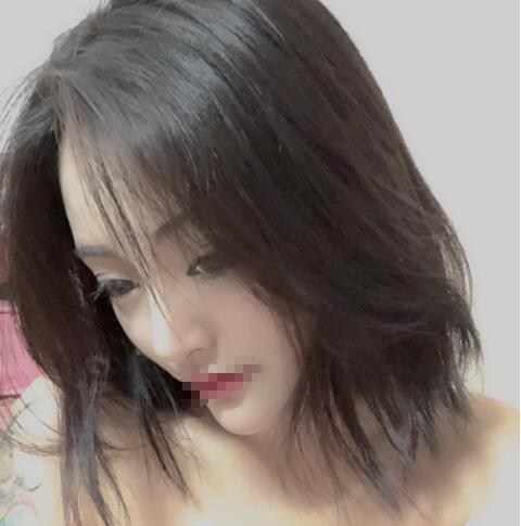 上海赛美瑞整形张化举鼻综合一个月效果