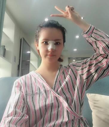 北京圣嘉荣整形吕玲玲硅胶隆鼻术后第二天效果