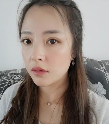 手术恢复后