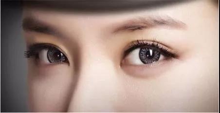 杭州迪美医疗美容门诊部做开内眼角术后效果