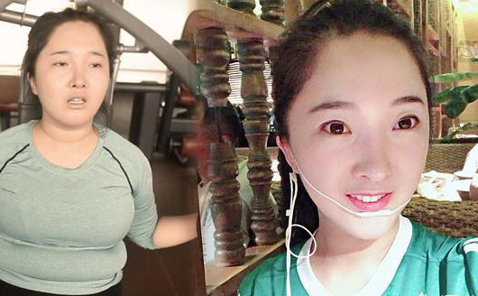 埋线减肥是什么?这种减肥做法具有科学性吗?