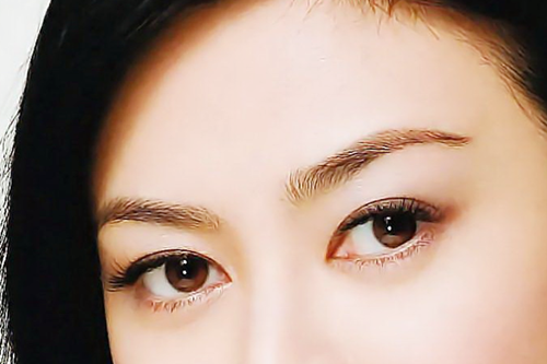 怀化华美美莱整形开眼角