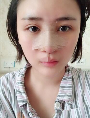 术中效果