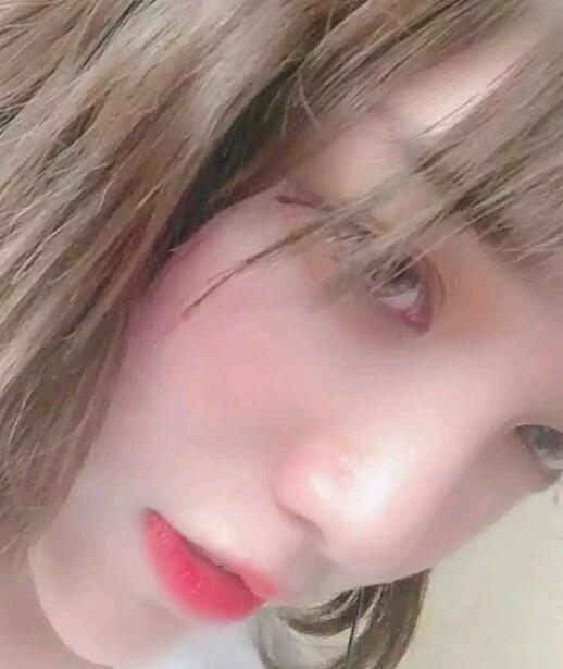 注射隆鼻恢复中