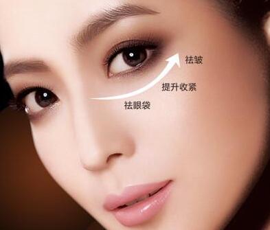 南昌韩雅医疗美容诊所眼袋脂肪释放