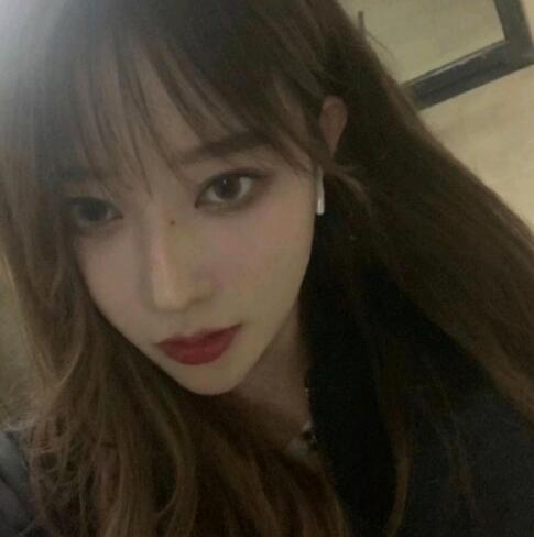 亳州华美整形美容医院李剑医生玻尿酸丰下巴案例效果分享