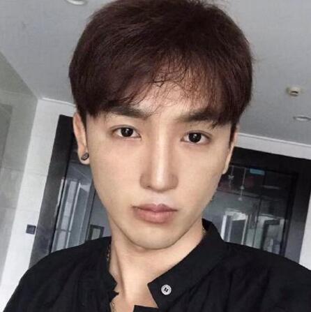 下颌角磨骨手术之后