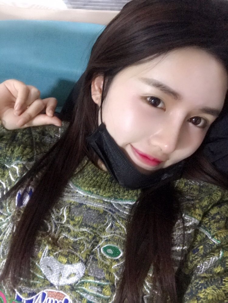 北京星美李宁辉进口膨体隆鼻案例效果对比图，鼻子自然又美丽