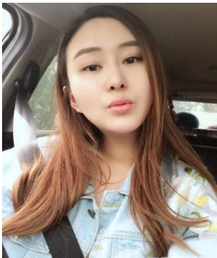 双美胶原蛋白注射丰唇效果