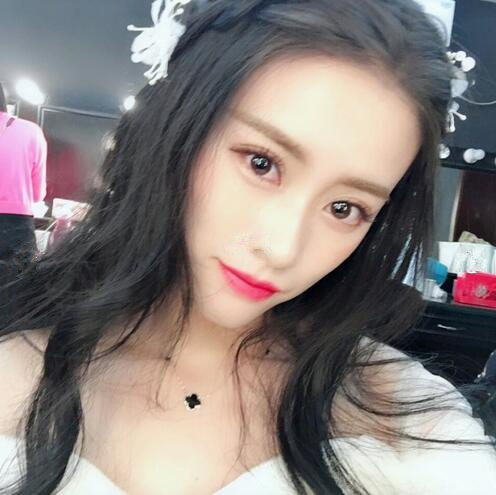长春铭妍医疗美容门诊部做双眼皮怎么样？长春铭妍双眼皮案例分享