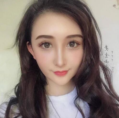 昆医整形脂肪填充全脸效果