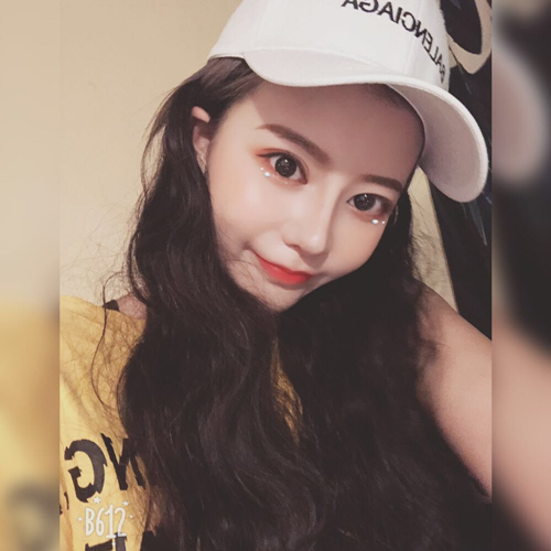 嘉兴曙光美容医院整形专家王良发做假体隆鼻怎么样？王良发假体隆鼻案例