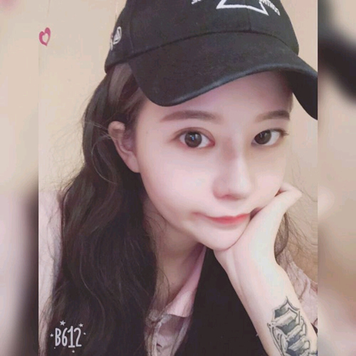王良发假体隆鼻案例效果对比图
