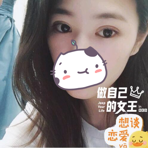西昌玥美整形专家汤颖峰做双眼皮怎么样？汤颖峰双眼皮案例赏析