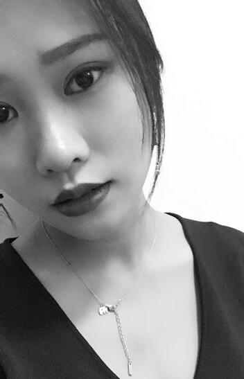 上海伊美尔港华整形医生师丽丽做双眼皮怎么样？师丽丽双眼皮案例分享