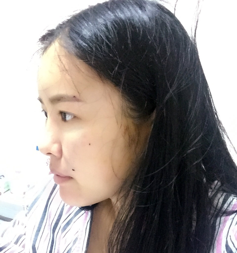 手术当天