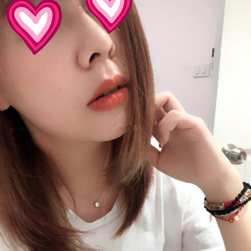 隆鼻之后：