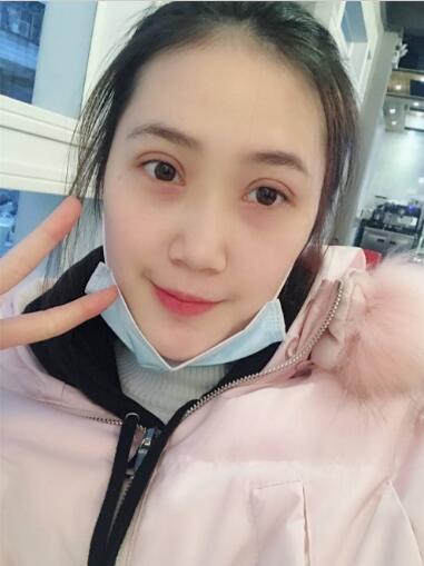 手术两周后