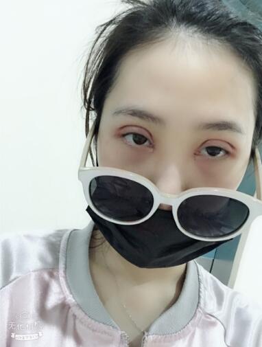 手术之后