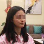安徽立新医学美容医院程立新医生面部吸脂案例效果对比图