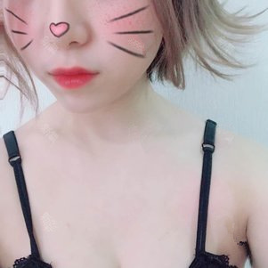 孙轶峰做假体隆胸案例效果对比图